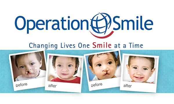 operation-smile