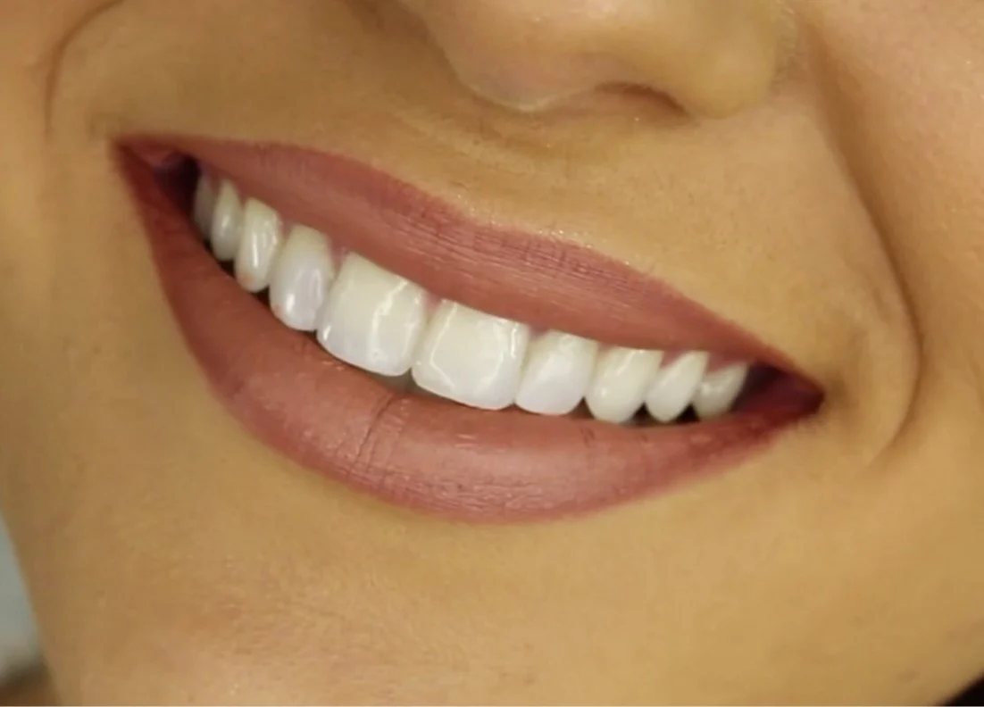 Improve Your Health and Appearance Right Now smile
