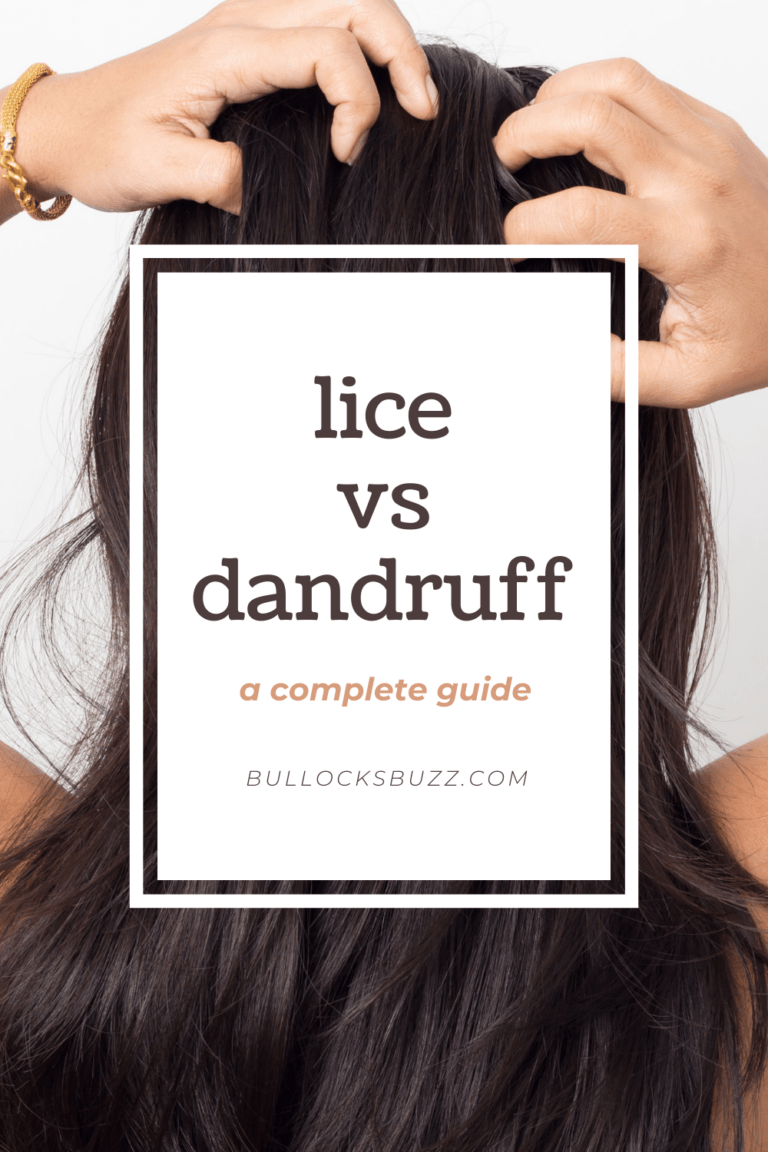Lice vs. Dandruff A Complete Guide Bullock's Buzz