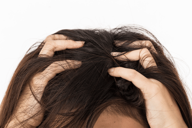 Lice vs. Dandruff A Complete Guide Bullock's Buzz