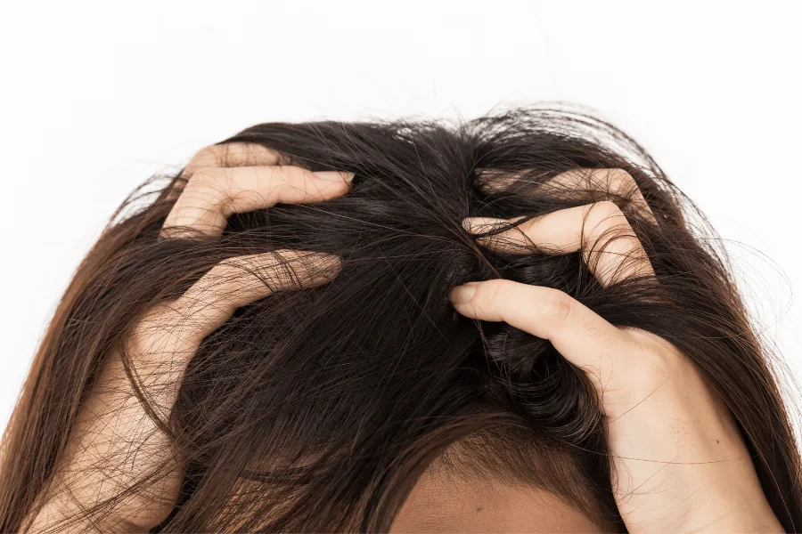 lice vs. dandruff a complete guide