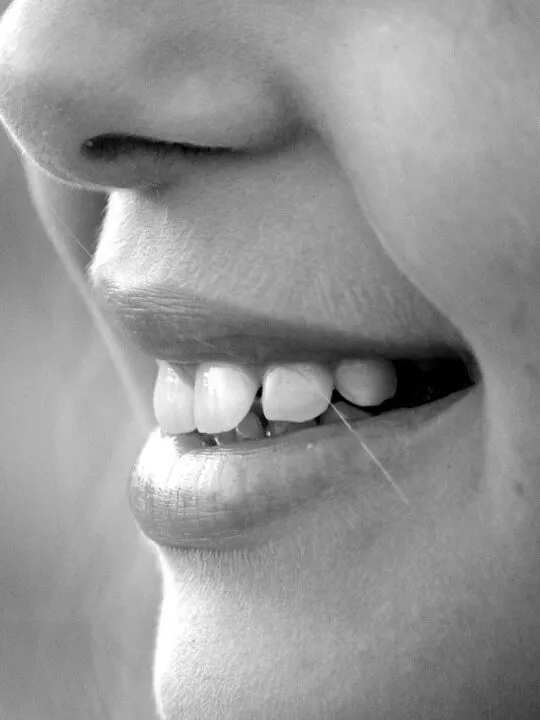 Common Oral Health Mistakes that can ruin your smile like this one