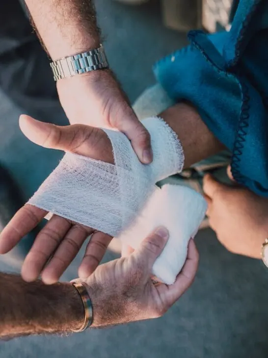 Man wrapping a person's hand after getting burned, one of the most common causes of personal injury