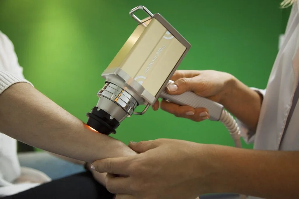 A doctor using a tool for skin cancer on a patients arm
