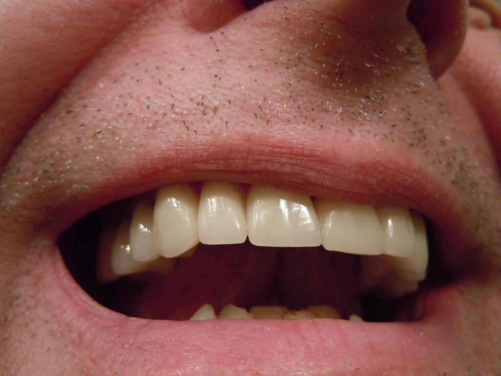 Close up of a healthy smile. Dental care after 50 becomes even more important.