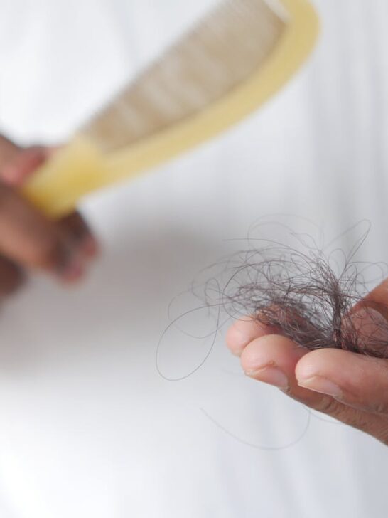 Man holding a brush in one hand and lost hair in another. Early treatment for thinning hair is one solution