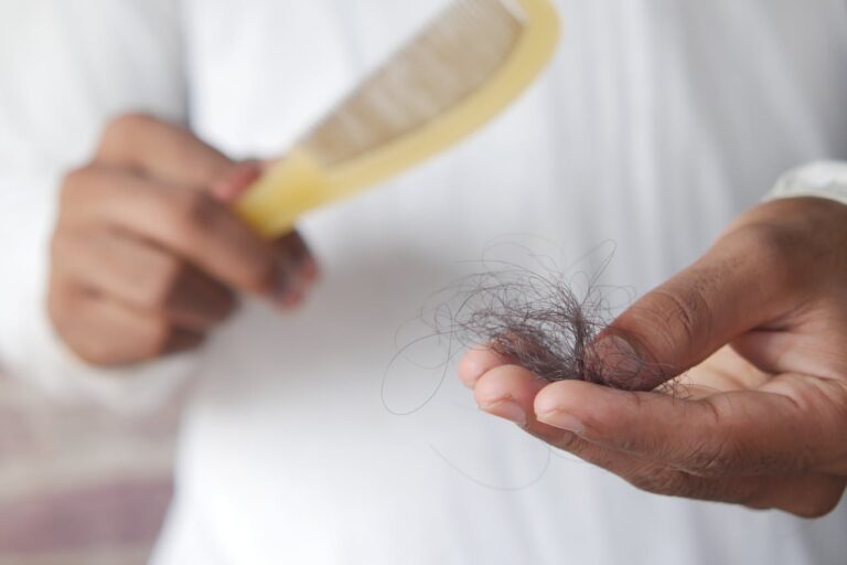 Man holding a brush in one hand and lost hair in another. Early treatment for thinning hair is one solution