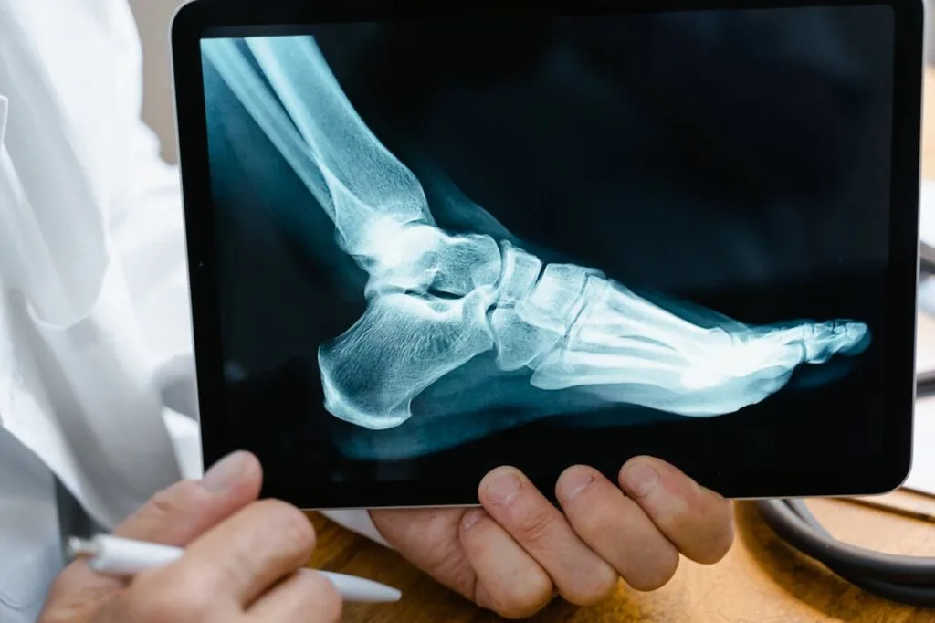 A healthcare professional holds a tablet showing an X‑ray of a foot and ankle, highlighting injury risks that can disrupt long‑term health goals and the importance of proper diagnosis and treatment.