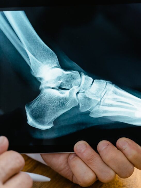 A healthcare professional holds a tablet showing an X‑ray of a foot and ankle, highlighting injury risks that can disrupt long‑term health goals and the importance of proper diagnosis and treatment.