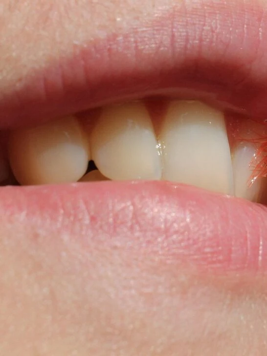 Close-up of a person brushing their teeth near the gumline, showing proper technique as part of a daily oral health routine.