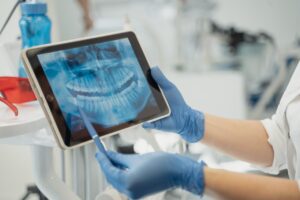 Dentist reviewing digital dental X-ray on tablet during patient consultation using advanced diagnostic technology.