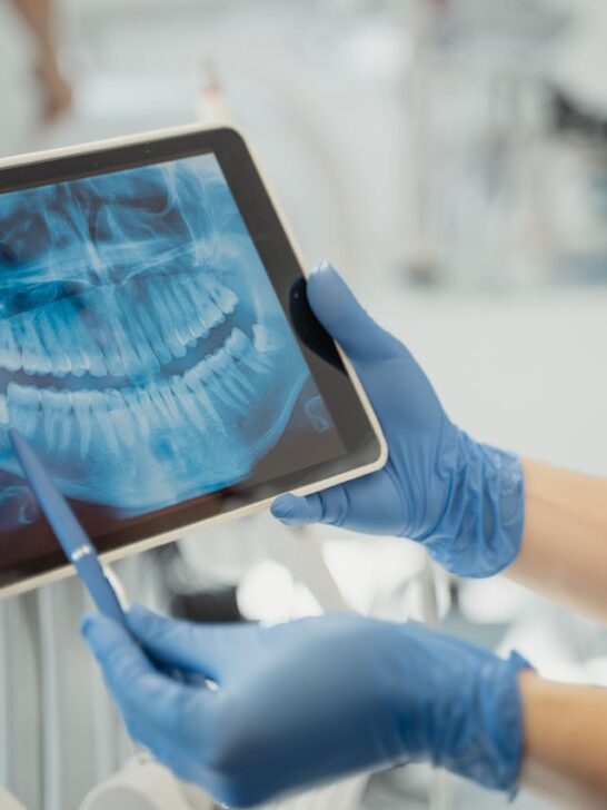 Dentist reviewing digital dental X-ray on tablet during patient consultation using advanced diagnostic technology.