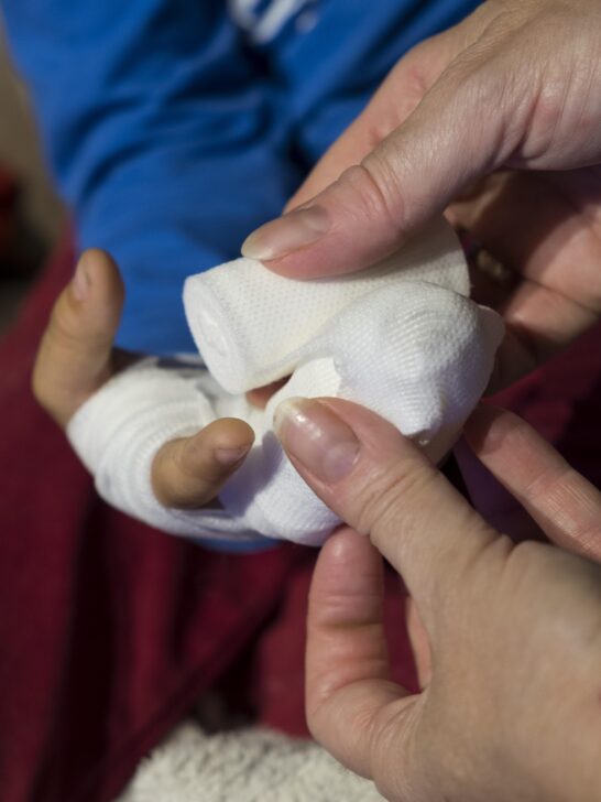 Close-up of a hand being wrapped in medical gauze after an accident, illustrating public event injury liability.