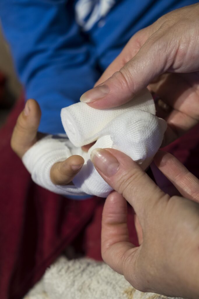 Close-up of a hand being wrapped in medical gauze after an accident, illustrating public event injury liability.