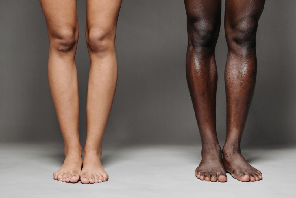 Two people standing barefoot, accompanying an article answering “why do my legs feel heavy?”